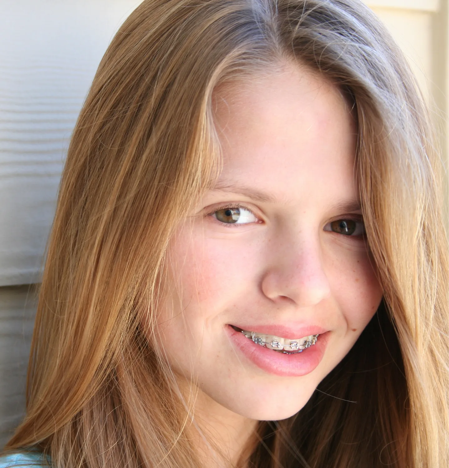 Braces for Teens Kinser Orthodontics